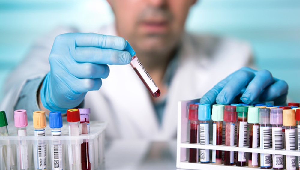 Ricerca. Gli alimenti a basso indice glicemico prevengono il diabete