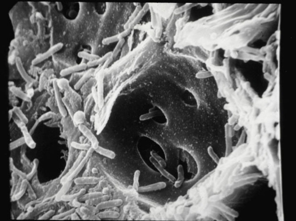 Ricerca. Una piattaforma elettronica per prevenire Xylella