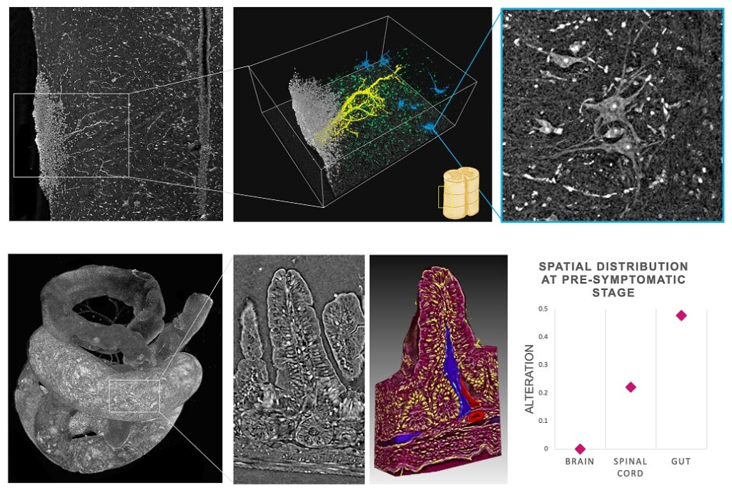 Ricerca. Comprendere le malattie neurodegenerative con i raggi X