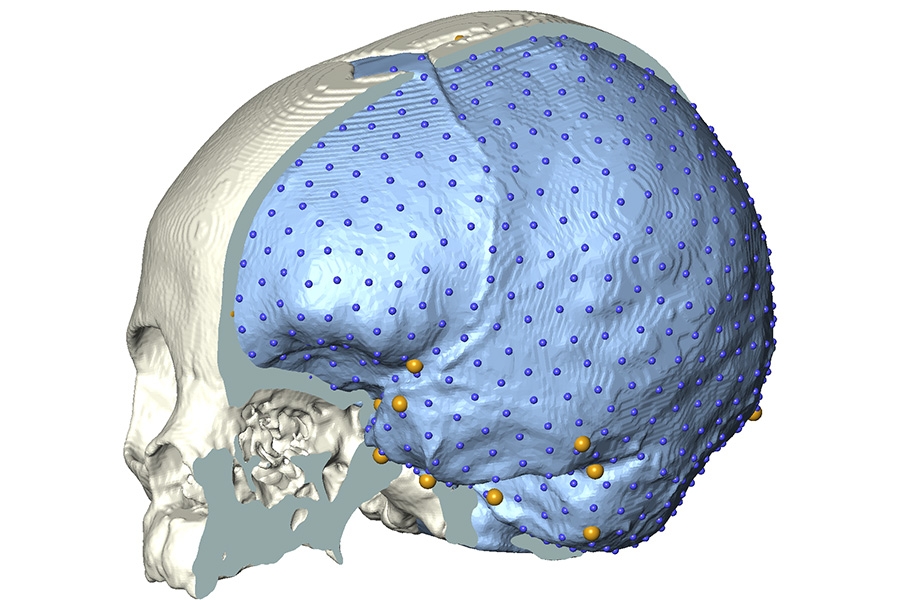 Ricerca. L’“eterna giovinezza” del cervello di Homo sapiens mai diventato adulto