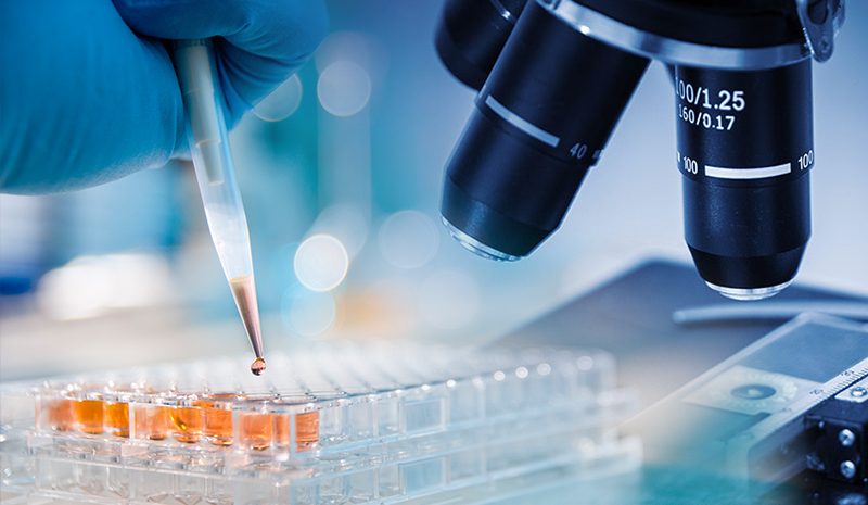 Ricerca.  Individuate mutazioni genetiche che causano il Parkinson nel 5% dei pazienti