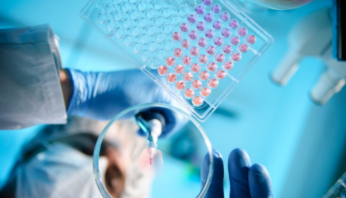 La molecola NGF per limitare i danni cerebrali