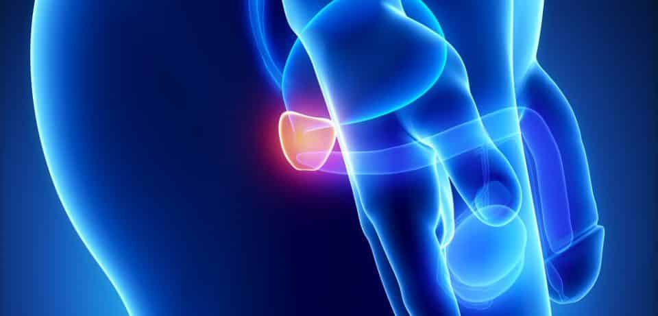 Ricerca. Un cannabinoide non psicoattivo contro il carcinoma prostatico