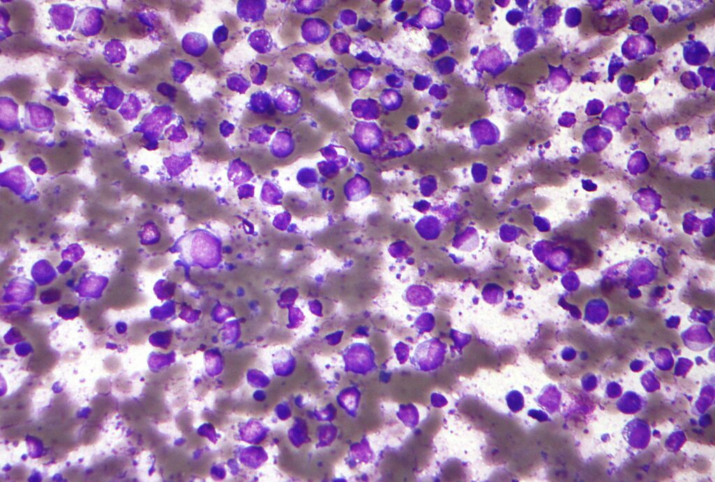 Oncologia. Istituto di Candiolo tra i top 50 al Mondo