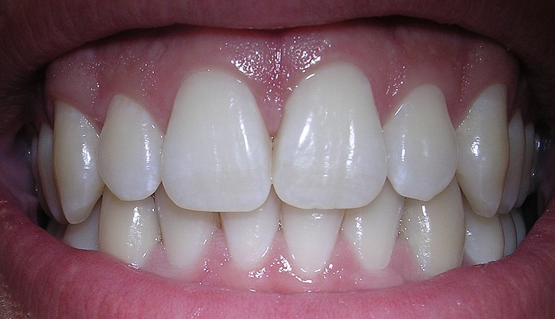 Centro dentistico: quali sono gli interventi praticati?