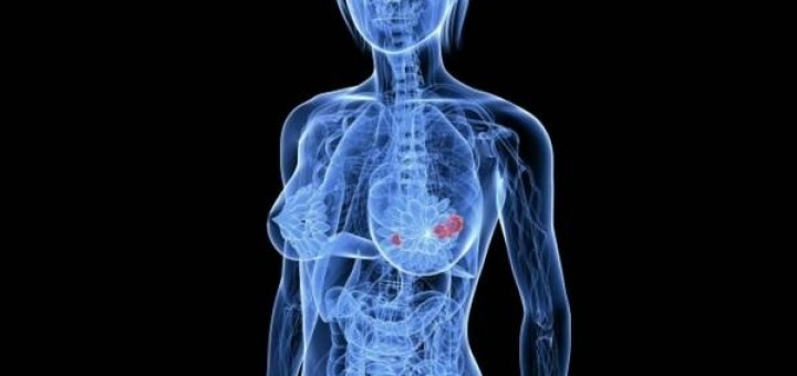 Ricerca. Dall’Enea l’innovativa terapia per curare il tumore al seno