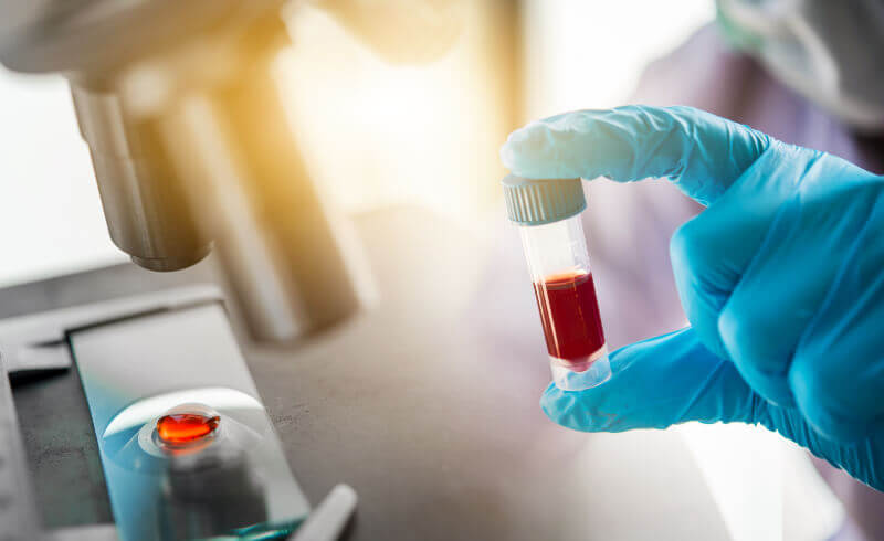 Stemline Therapeutics acquisisce la licenza per farmaco anti cancro
