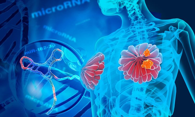 Genova, eccellenza nella ricerca e assistenza per il cancro al seno