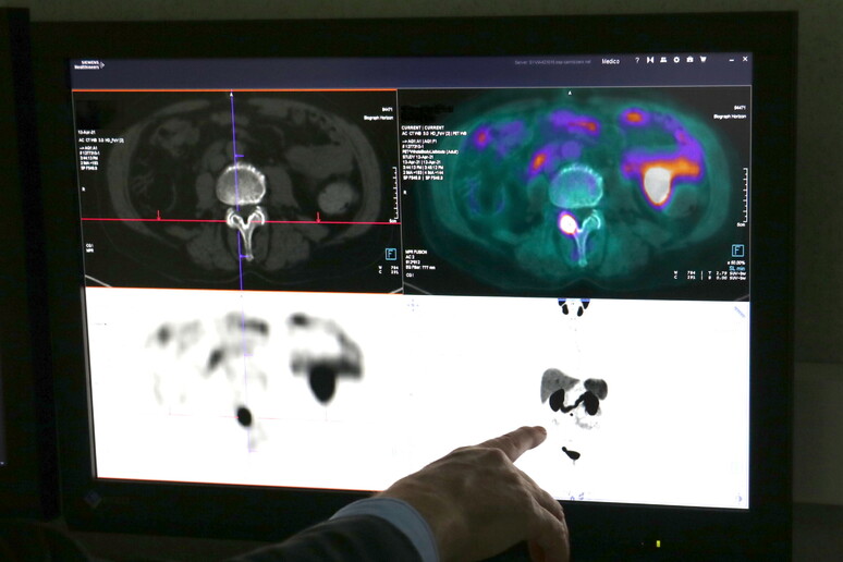 Al Policlinico Bari, nuovo radiofarmaco per diagnosi tumori