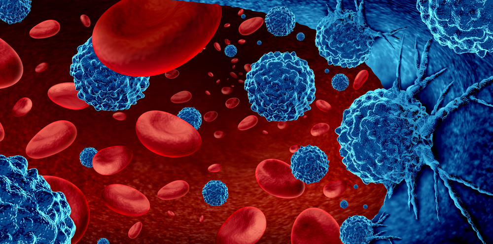 Nuove scoperte sul linfoma follicolare