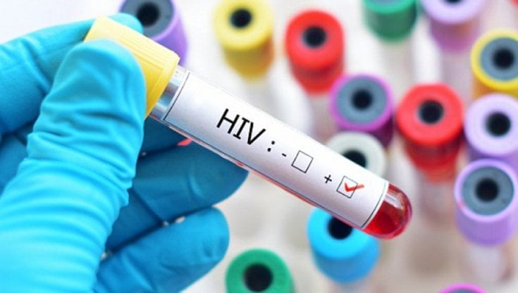 Fine dell’epidemia da HIV? Gli scienziati sono cautamente ottimisti