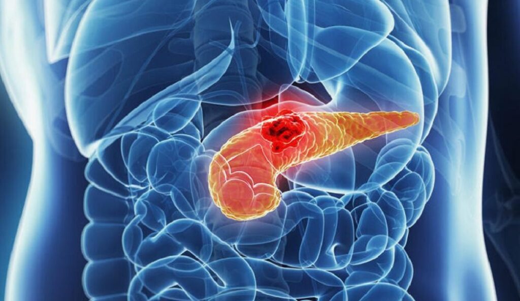 Ricerca. Nuove terapie per il cancro al pancreas