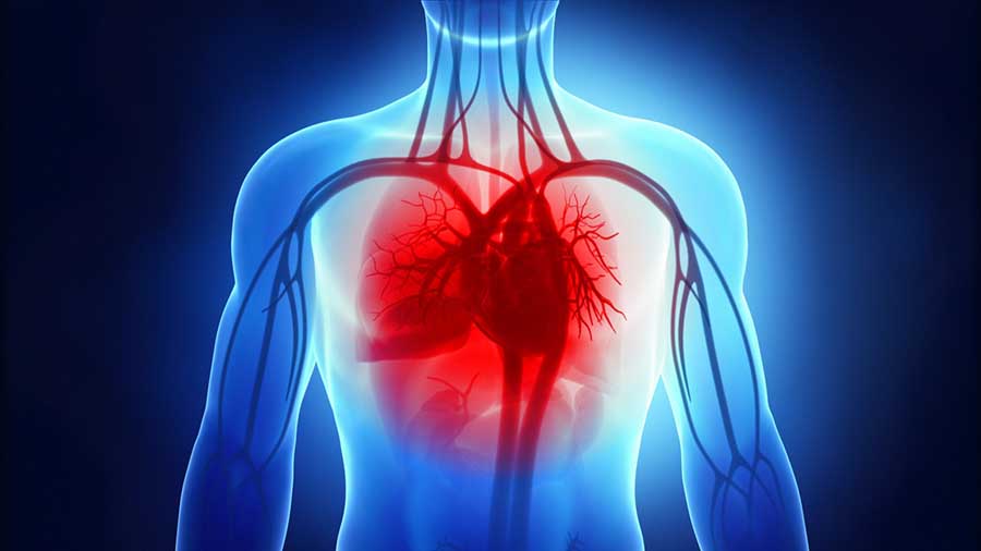 Insufficienza cardiaca. Nuovi scenari con il cuore artificiale totale