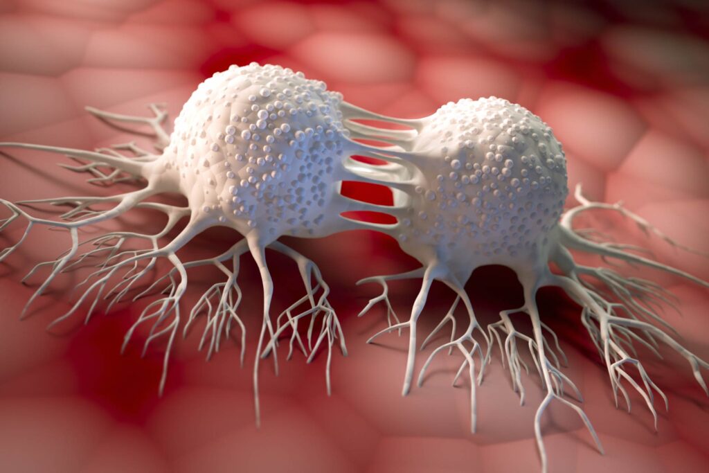 Tumori e recidiva: scoperti nuovi marcatori metabolici per il linfoma B