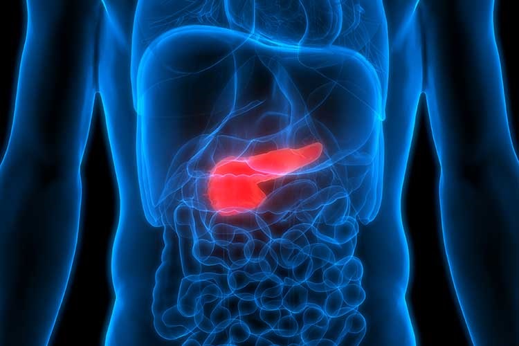 Tumore pancreas. Scoperti cerchi di DNA nascosti